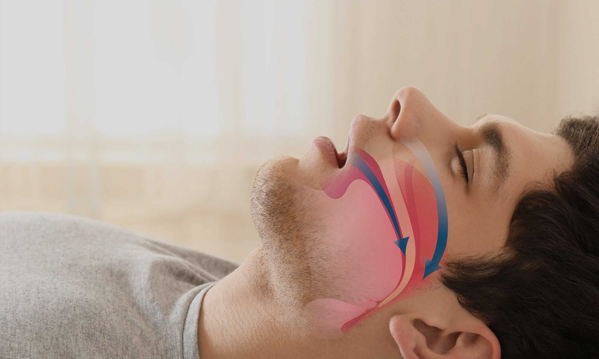 Snoring man with airaway animated over facial profile